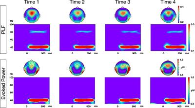 Long-Term Test-Retest Reliability of Auditory Gamma Oscillations Between Different Clinical EEG Systems